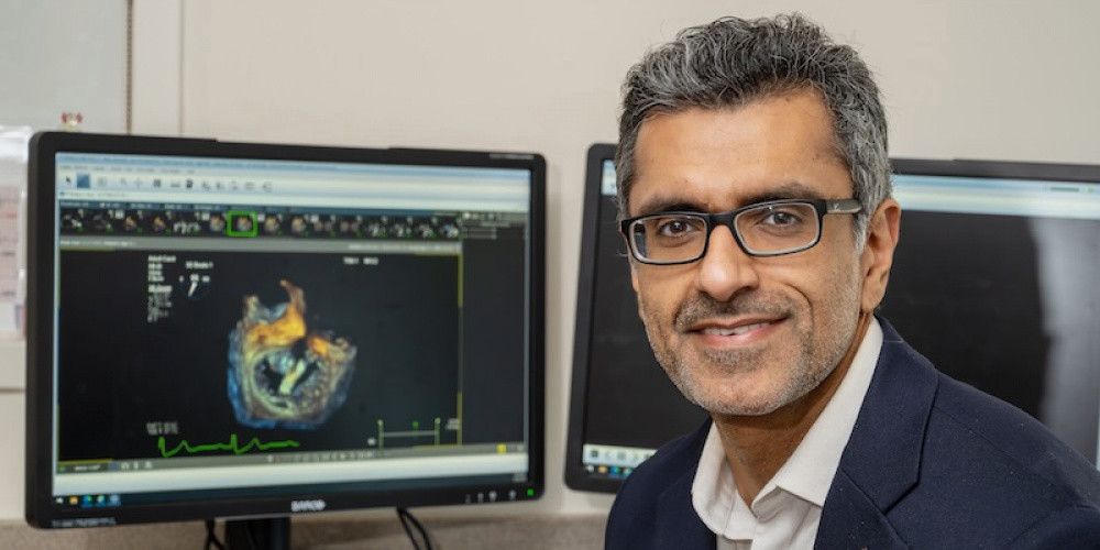 image:Ankur Kalra, MD, MSc, FACP, FACC, FSCAI, helped lead a research team that developed and tested an explainable AI scoring system to identify severe heart attack patients at high risk of bleeding into damaged heart muscle. (Image Credit: SUNY Upstate Medical University)