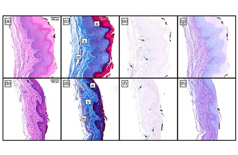 Image: Raman spectroscopy showed that optical biomarkers associated with mature, functional elastic fibers were significantly reduced in the fibulin-5 deficient models. Histological staining (pictured here) confirmed substantial decrease in the amount of functional elastic fibers present within vaginal tissue. (Image Credit: Vanoven et al., doi 10.1117/1.BIOS.3.3.032106)