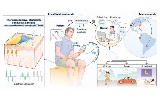 Image: Schematic illustration of the wireless IoT-based microneedle electroceutical system for personalized and remote pain management (Photo courtesy of KAIST)