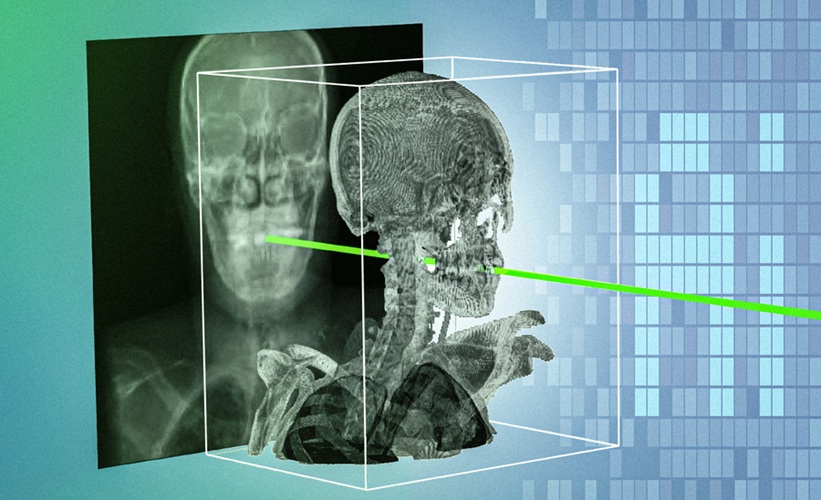 Image: The new system uses an AI model that automatically matches one patient’s X-rays with 3D scans in a matter of seconds, and with sub-millimeter precision (Photo courtesy of Vivek Gopalakrishnan, Polina Golland)