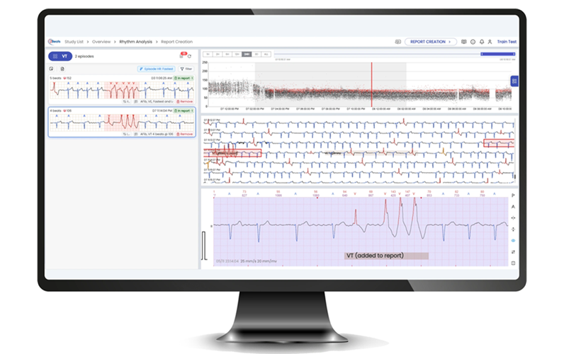 Image: ZBPro Diagnostic v2.0 supports ECG analysis periods ranging from one minute to 14 days for both Holter and wearable patch recordings (Photo courtesy of ZBeats, Inc.)