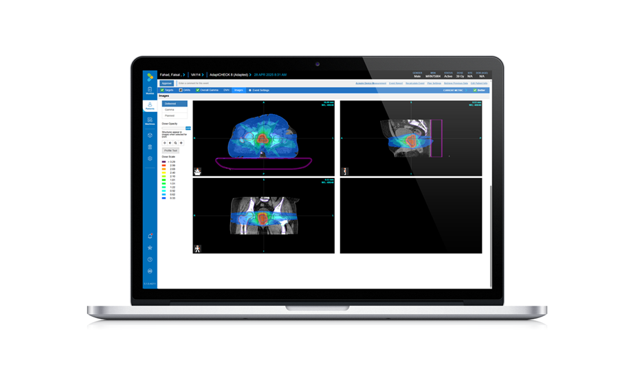 Image: Built on the SunCHECK Patient workflow, AdaptCHECK provides quality assurance for adaptive radiation therapy through rapid, patient-specific dose verification. (Photo courtesy of Mirion Medical)