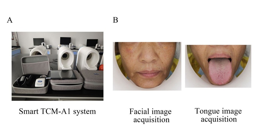 Image: Smart TCM-A1 system and demonstrations of image acquisition. (Wang, Y., Xu, W., Wang, Z. et al. Explainable multimodal deep learning fusion of tongue and facial images for noninvasive coronary heart disease screening. Scientific Reports, 2026. https://doi.org/10.1038/s41598-026-71871-x)