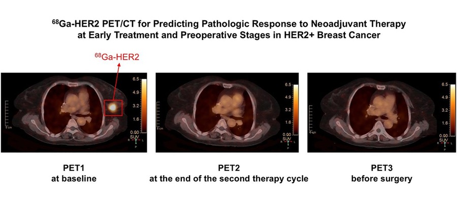 Image: Visual Abstract (Sinuo Gao, Zhaoqi Zhang, Chao Shi, Cheng Cheng, Xindi Ma, Xinming Zhao, Yunjiang Liu Journal of Nuclear Medicine Oct 2026, 67 (10) 1552-1559; DOI: 10.2967/jnumed.125.271529)