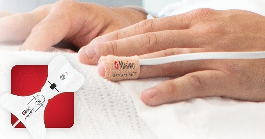 Image: Masimo smartSET pulse oximetry with PPG AFib and OIRD Detection (Photo courtesy of Masimo)