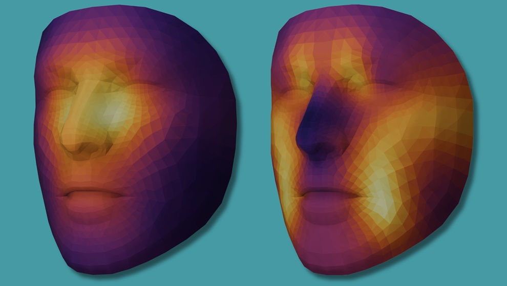Image: Mass General Brigham researchers developed two AI tools from one foundation model (called FAHR-Face) that can estimate biological age and predict cancer survival outcomes from a single face photo. The image on the left depicts the features most important to FAHR-FaceSurvival\'s predictions of cancer survival outcomes, while the image on the right shows the features most important to FAHR-FaceAge\'s estimates of biological age. Areas shown in yellow had the greatest influence on each model\'s predictions. (Photo courtesy of Mass General Brigham/Lancet Digital Health)