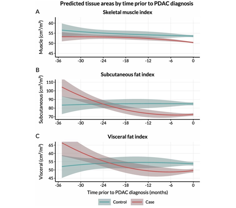 Image: Longitudinal trajectories of body composition from −36 months to 0 months for PDAC cases and matched controls: (A) Skeletal muscle index, (B) subcutaneous fat index and (C) visceral fat index. (Bogdanski AM, Klatte DCF, van Hooft JE, et al. Longitudinal body composition changes distinguish pancreatic ductal adenocarcinoma from controls in a pre-diagnostic CT cohort. Pancreatology. 2026. doi:10.1016/j.pan.2026.09.00)