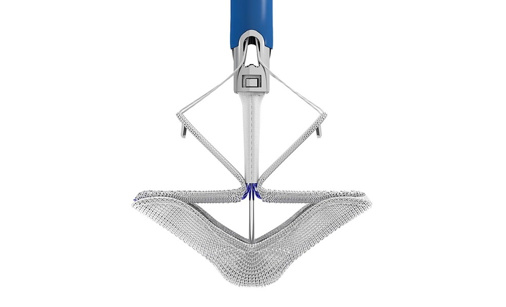 Image: Edwards Lifesciences\' PASCAL transcatheter tricuspid valve repair system (Photo courtesy of Edwards Lifesciences)