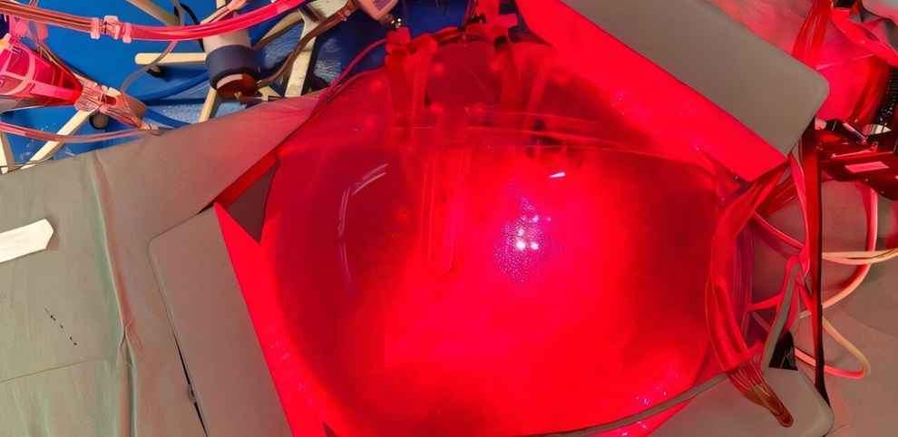 Image: Light-based therapy applied to a lung intended for transplantation. The same type of light source can be used to treat pneumonia. (Image Credit: Cristina Kurachi)