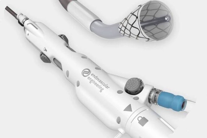 Illustration of the Hēlo Thrombectomy System device (Photo courtesty of Endovascular Engineering)
