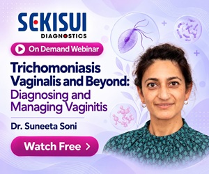 Sekisui Diagnostics