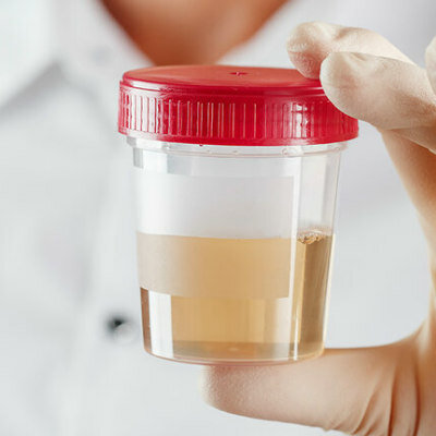 SPECIMEN COLLECTION CONTAINERS