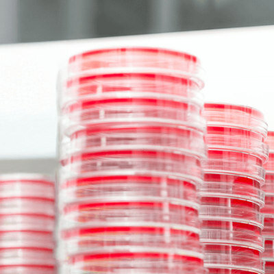 MICROBIOLOGY CONSUMABLES