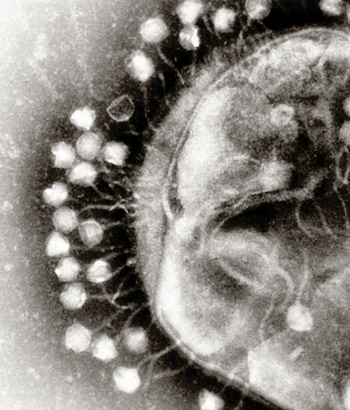 Image: Electron micrograph of bacteriophages attached to a bacterial cell (Photo courtesy of Wikimedia Commons).