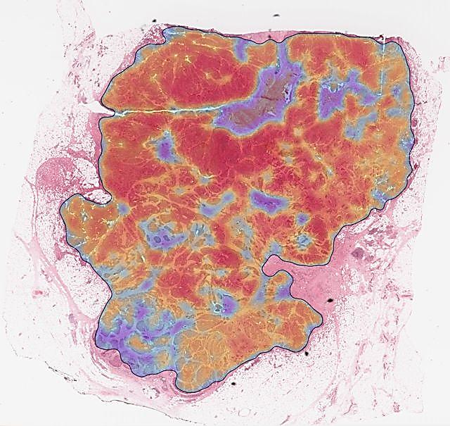 Image: TissueMark automated markup of a histological section (Photo courtesy of PathXL).