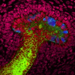Image: Salk Institute scientists have grown human stem cells into early-stage ureteric buds. They used mouse embryonic kidney cells (seen here in red) to coax the human stem cells to grow into the nascent mushroom-shaped buds (blue and green) (Photo courtesy of the Salk Institute for Biological Studies).