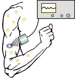 Image: A new technique allows diabetics to control insulin release with an injectable nano-network and portable ultrasound device (Photo courtesy of North Carolina State University).