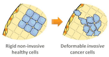 Image: Invasive deformability: a transition to invasive malignant cells in a tumor is associated with the cell\'s increased ability to stretch, which may allow for invasion through tight tissue junctions (Photo courtesy of UCLA - University of California, Los Angeles).