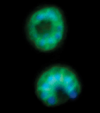 Image: Malaria parasites (labeled with fluorescent protein) in the late stages of development, superimposed on a field of red blood cells. The many nuclei of the parasites\' daughter cells are labeled in blue, and the plasma membranes surrounding the daughter cells are labeled in green. Imidazopyrazine treatment disrupts formation of the membranes around the daughter cells (Photo courtesy of Dr. Marcus C.S. Lee, Columbia University Medical Center).
