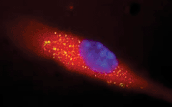 Image: The glowing yellow specks in the image show uptake of the nanosponge vaccine by a mouse immune system dendritic cell. The detained alpha-hemolysin toxins were labeled with a fluorescent dye, which glows yellow. The cell membrane was stained red and the nuclei stained blue (Photo courtesy of the University of California, San Diego,  Department of NanoEngineering).