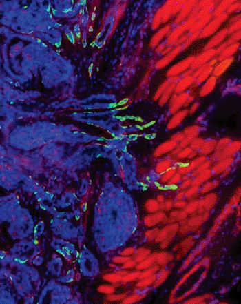 Image: A breast tumor (blue) uses leader cells (green) to invade muscle tissue (red) in a mouse (Photo courtesy of Dr. Kevin Cheung, Cell).