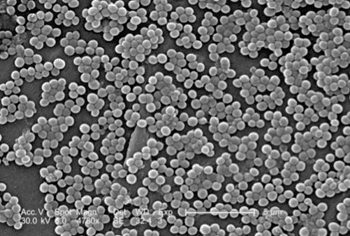 Image: Scanning electron micrograph (SEM) showing numerous clumps of methicillin-resistant Staphylococcus aureus (MRSA) magnified 4,780x (Photo courtesy of the CDC - Centers for Disease Control and Prevention).