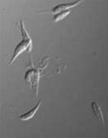 Image: Phase contrast showing location of whole cells (Photo courtesy of Prof. C.L. Jaffe, Hebrew University, and of PLOS One).