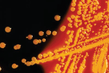Image: Colonies of Escherichia coli growing in a laboratory culture (Photo courtesy of the CDC - Centers for Disease Control and Prevention).