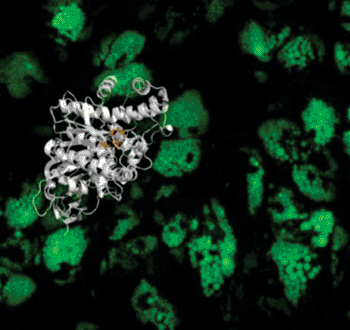Image: As proof of the power of their new screening strategy, researchers at The Scripps Research Institute used the method to identify a compound that shows promise for treating obesity-linked diabetes. This image shows a structure identified as a target for obesity-diabetes (human Ces3), superimposed on a field of human fat cells with their lipids stained with a fluorescent dye (Photo courtesy of the Scripps Research Institute).
