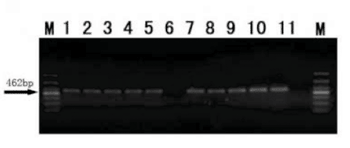 Image: PCR products of methylenetetrahydrofolate reductase C677T DNA samples extracted with magnetic nanoparticles using saliva samples (lanes 1-5) and with traditional methods using blood samples (lanes 7-11) (Photo courtesy of Neural Regeneration Research).