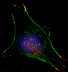 Image: A breast cancer cell in normal oxygen conditions (Photo courtesy of Dr. Daniele Gilkes, Johns Hopkins University).