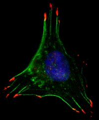Image: In low oxygen conditions, breast cancer cells form structures that facilitate movement, such as filaments that allow the cell to contract (green) and cellular \"hands\" that grab surfaces to pull the cell along (red) (Photo courtesy of Dr. Daniele Gilkes, Johns Hopkins University).