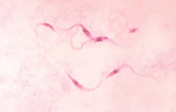 Image: Trypanosoma cruzi in blood smear from patient with trypanosomiasis (Photo courtesy of the CDC – [US] Centers for Disease Control and Prevention).