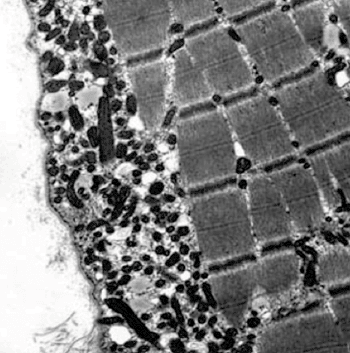 Image: Electron micrograph showing an increased number of mitochondria in the subsarcolemmal space from a patient with mitochondrial myopathy (Photo courtesy of the Virginia Commonwealth University).