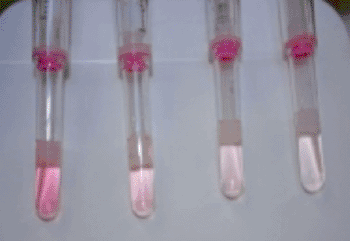 Image: Development of a pink color indicates a positive Saliva Smokescreen result (Photo courtesy of GFC Diagnostics).