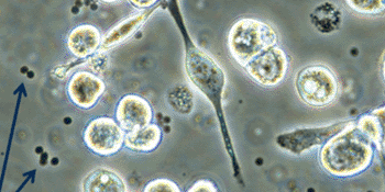 Image: Virus-infected cells after treatment with Vecoy nanoparticles (indicated by arrows) (Photo courtesy of Vecoy Nanomedicines).