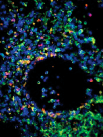 Image: Lung tissue from cIAP2-deficient mice showing effects on epithelial cells of influenza infection (Photo courtesy of McGill University).