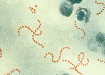 Image: Photomicrograph (900x) of Streptococcus pyogenes bacteria, viewed using Pappenheim\'s stain (Photo courtesy of the CDC - [US] Centers for Disease Control and Prevention).
