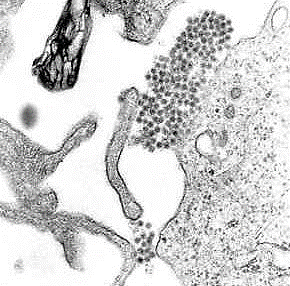 Image: A transmission electron micrograph showing Dengue virus virions (mass of round grey and black shapes appear to the right and few more below (Photo courtesy of the University of South Carolina).