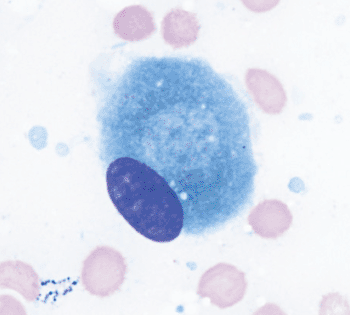 Image: An osteoblast in a bone marrow sample (Photo courtesy of Gabriel Caponetti).