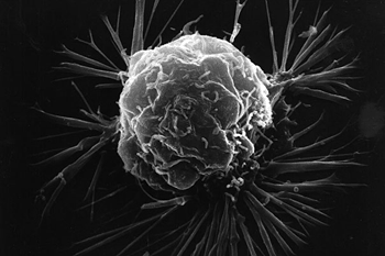 Image: Breast cancer cell. Triple-negative breast cancer is an aggressive disease with few therapeutic options. Patients with such tumors can be treated only with chemotherapy (Photo courtesy of the National Cancer Institute).
