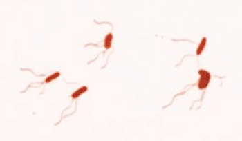 Image: Photomicrograph of Bordetella bronchiseptica using Leifson flagella stain (Photo courtesy of William A. Clark).
