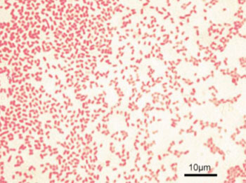 Image: Microscopic image of gram-negative Pseudomonas aeruginosa bacteria (pink-red rods) (Photo courtesy of Wikimedia Commons).
