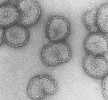 Image: Electron micrograph of influenza viruses (Photo courtesy of University of Saskatchewan).
