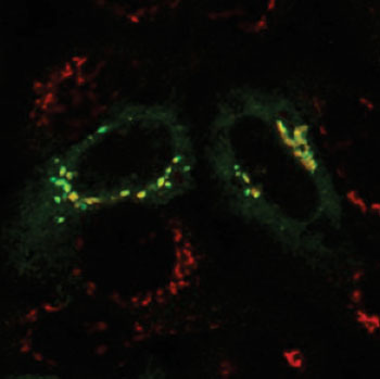 Image: In normal cells, phosphotransferase (green) is shown overlapping with the Golgi apparatus (red), which indicates that phosphotransferase is located in the Golgi, where it should be (Photo courtesy of Dr. Eline van Meel, Washington University School of Medicine).