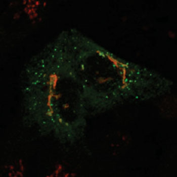 Image: In mutant cells, the protein phosphotransferase (green) is spread beyond the Golgi (red). Outside the Golgi, this wayward phosphotransferase is no longer able to perform its job of properly addressing enzymes bound for the lysosome (Photo courtesy of Dr. Eline van Meel, Washington University School of Medicine).