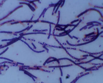 Caption: The anthrax bacteria – Bacillus anthracis, transmitted mainly through inhalation or skin abrasions (Photo courtesy of University of Missouri).