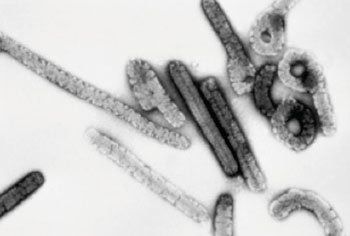 Image: Marburg virus (Photo courtesy of the CDC – US Centers for Disease Control).