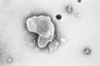 Image: Electron micrograph reveals the morphologic traits of the respiratory syncytial virus (RSV). The virion is variable in shape, and size (average diameter of between 120–300 nm). RSV is the most common cause of bronchiolitis and pneumonia among infants and children under one year of age (Photo courtesy of the CDC - [US] Centers for Disease Control and Prevention).