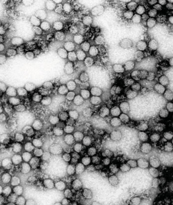 Image: Electron micrograph of yellow fever virions (Photo courtesy of Dr. Erskine Palmer).
